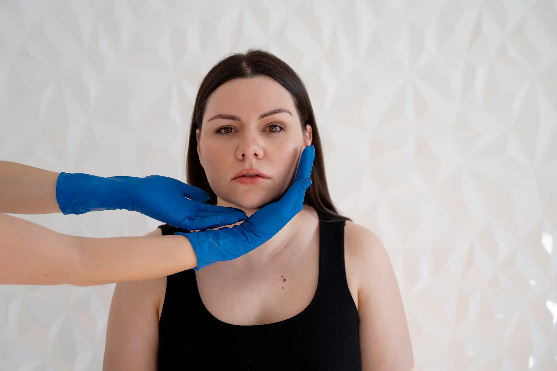 Tratamiento paralisis facial